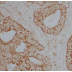 Dopamine Beta Hydroxylase (DBH) Antibody
