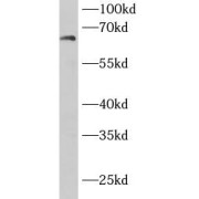 WB analysis of HeLa cells, using DBH antibody (1/1000 dilution).