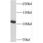 WB analysis of Jurkat cells, using USP11 antibody (1/1000 dilution).