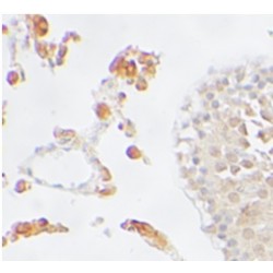 Peroxisome Proliferator Activated Receptor Delta (PPARD) Antibody