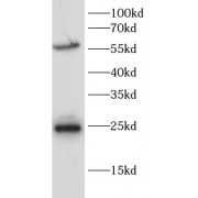WB analysis of Rat heart, using PPARD antibody (1/1000 dilution).
