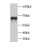 WB analysis of Jurkat cells, using GAD1 antibody (1/1000 dilution).