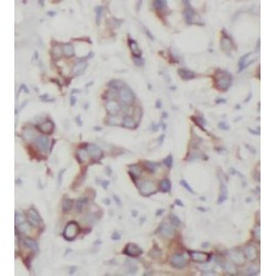 Hexokinase 2 (HK2) Antibody