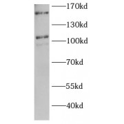 WB analysis of MCF7 cells, using HYOU1 antibody (1/1000 dilution).