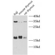 WB analysis of various lysates, using IL22 antibody (1/1000 dilution) dilution).