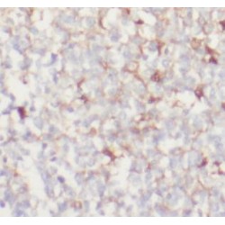 Integrin Alpha-E / CD103 (ITGAE) Antibody