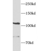 WB analysis of HeLa cells, using ITGAE antibody (1/1000 dilution).