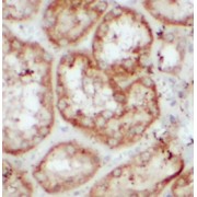 IHC-P analysis of human kidney tissue, using SLC4A4 antibody (1/100 dilution).