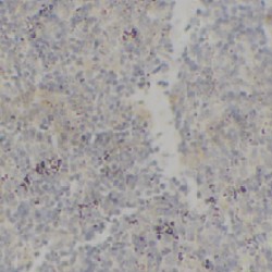 Linker For Activation Of T-Cell (LAT) Antibody