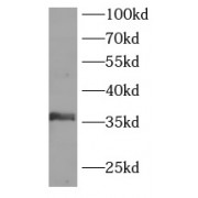 WB analysis of Jurkat cells, using LAT antibody (1/1000 dilution).