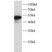 WB analysis of Jurkat cell lysates, using LEF1 antibody (1/1000 dilution).
