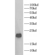 WB analysis of rat testis tissue, using GPX4 antibody (1/1000 dilution).