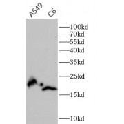 WB analysis of various lysates, using NME1 antibody (1/1000 dilution).