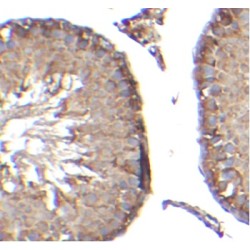 P2Y Purinoceptor 2 (P2RY2) Antibody