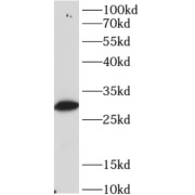 WB analysis of mouse heart, using PPP1CB antibody (1/1000 dilution).