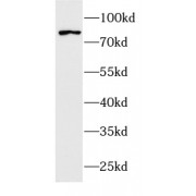 WB analysis of Rat skeletal muscle, using RAF1 antibody (1/1000 dilution).