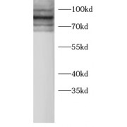 WB analysis of HeLa cells, using KS6A1 antibody (1/1000 dilution).