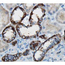 Hepatocyte Growth Factor (HGF) Antibody
