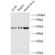 WB analysis of various lysates, using HGF antibody (1/1000 dilution).