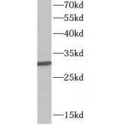 WB analysis of MCF-7 cells, using SFN antibody (1/1000 dilution).