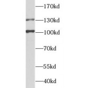 WB analysis of HepG2 cells, using ZEB2 antibody (1/1000 dilution).