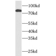 WB analysis of Rat liver tissue, using STAT1 antibody (1/1000 dilution).