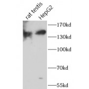 WB analysis of various lysates, using ST5 antibody (1/1000 dilution).