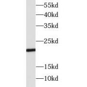 WB analysis of mouse lung, using SOCS1 antibody (1/1000 dilution).