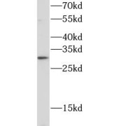 abx219124