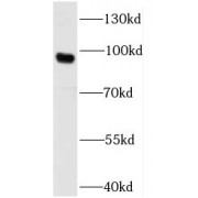 WB analysis of HeLa cells, using UNC5A antibody (1/1000 dilution).