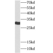 WB analysis of A375 cells, using 14-3-3E antibody (1/2000 dilution).