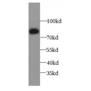 WB analysis of MCF7 cells, using ALOX15B antibody (1/600 dilution).