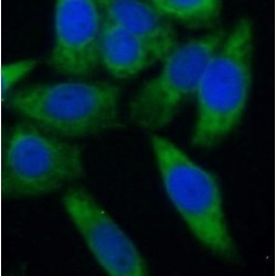 Eukaryotic Translation Initiation Factor 4E-Binding Protein 1 (4EBP1) Antibody