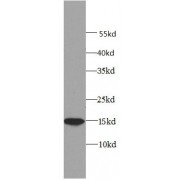 WB analysis of K-562 cells, using 4EBP1 antibody (1/2000 dilution).