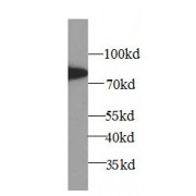 WB analysis of HL-60 cells, using ALOX5 antibody (1/600 dilution).