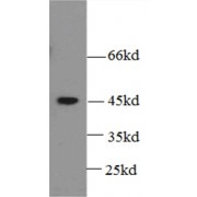 WB analysis of 6x His-tagged fusion protein, using 6x His-Tag Antibody (1/5000 dilution).