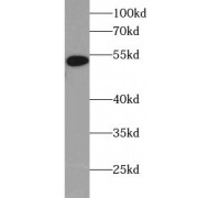 WB analysis of 6x His-tagged fusion protein, using 6x His-Tag antibody (1/1000 dilution).