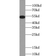 Western blot of 6x His-tagged fusion protein, using 6x His-Tagged Antibodu (1/2000 dilution).
