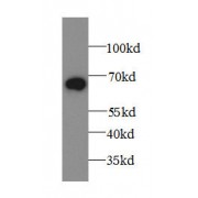 WB analysis of human plasma tissue, using A1BG antibody (1/5000 dilution).