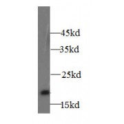 WB analysis of mouse lung tissue, using A2LD1 antibody (1/500 dilution).