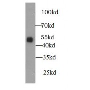 WB analysis of RAW 264.7 cells, using A4GALT antibody (1/1000 dilution).