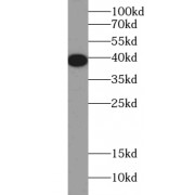 WB analysis of K-562 cells, using A4GNT antibody (1/1000 dilution).