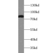 WB analysis of mouse heart tissue, using AACS antibody (1/300 dilution).