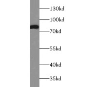 WB analysis of mouse heart tissue, using AACS antibody (1/300 dilution).