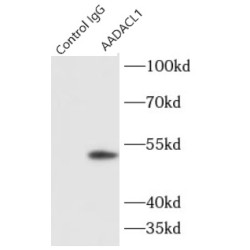 Arylacetamide Deacetylase-Like 1 (AADACL1) Antibody