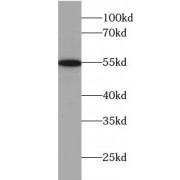 WB analysis of COLO 320 cells, using AADACL1 antibody (1/500 dilution).