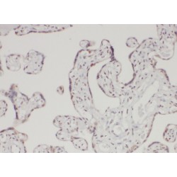 Angio Associated Migratory Cell Protein (AAMP) Antibody