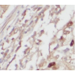 Alanine--TRNA Ligase, Mitochondrial (AARS2) Antibody