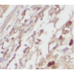 Alanine--TRNA Ligase, Mitochondrial (AARS2) Antibody