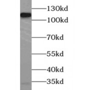 WB analysis of K-562 cells, using AARS2 antibody (1/1000 dilution).